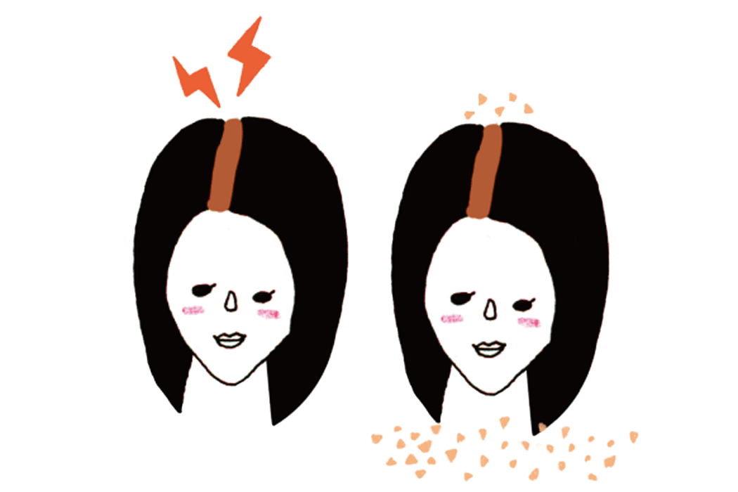 頭皮の乾燥or頭皮が硬い<br>フケor頭皮がかゆい