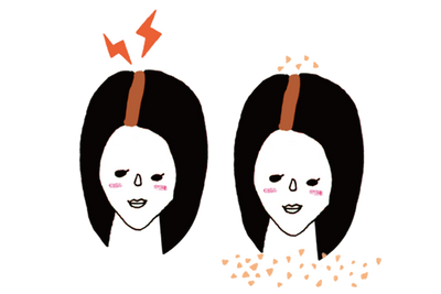 頭皮の乾燥or頭皮が硬い<br>フケor頭皮がかゆい